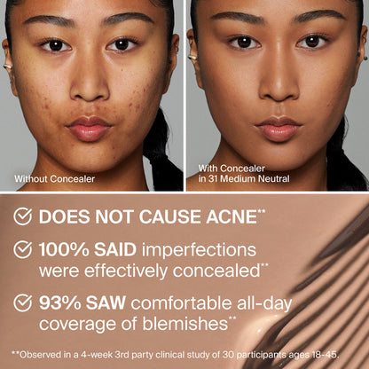 TRICLONE™ SKIN TECH HYDRATING + DE-PUFFING CONCEALER